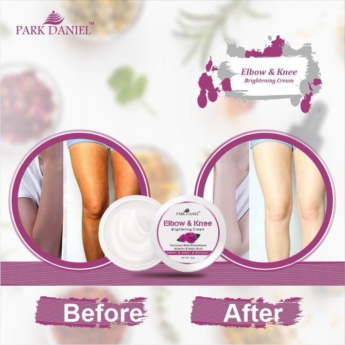 Park Daniel Elbow and Knee Whitening Cream - Dark Spot Removal Nourished Skin Pack of 2 (100 grams)